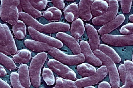 Louisiana Reports 5 Fatalities from Necrotizing Bacteria in Coastal Waters
